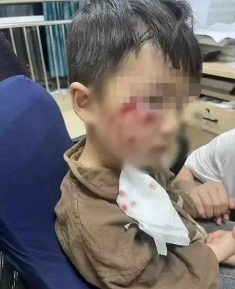 被瘋?cè)麤](méi)有“救命藥”，怎么辦？